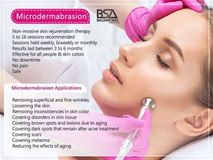 What does microdermabrasion do to your face?