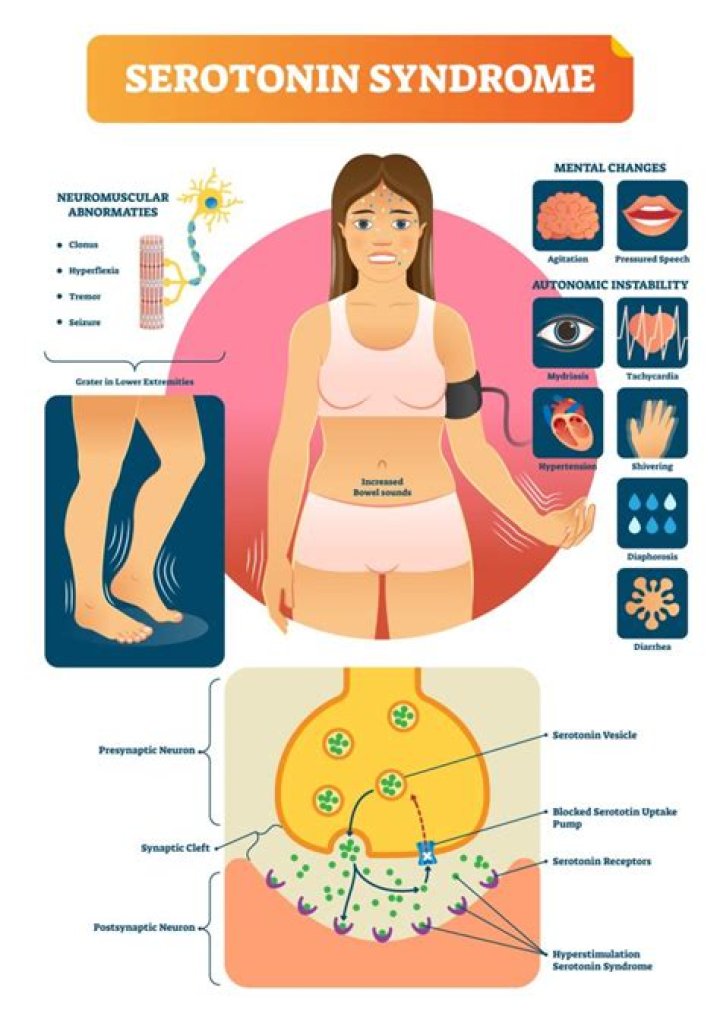What does mild serotonin syndrome feel like?