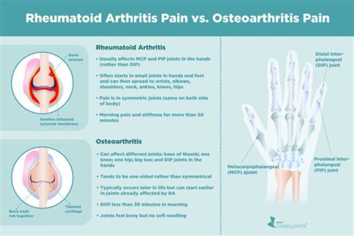 What does pain from osteoarthritis feel like?