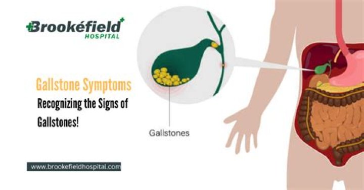 What does passing a gallstone feel like?