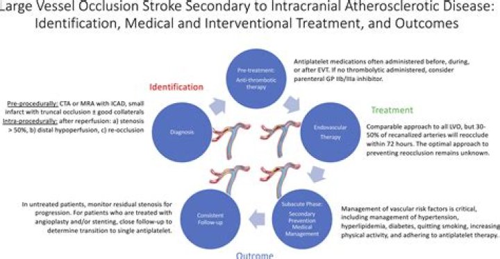 What is considered a large stroke?