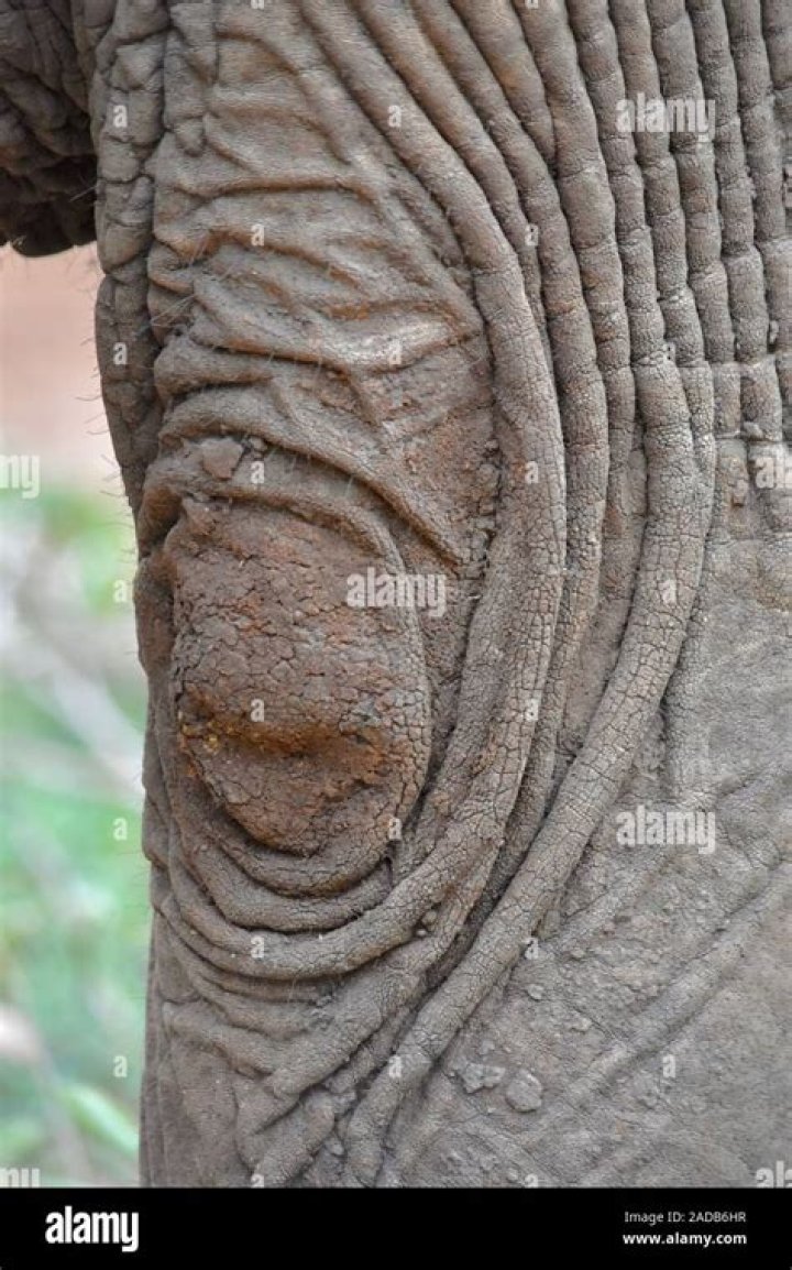 What is Elephant elbow?