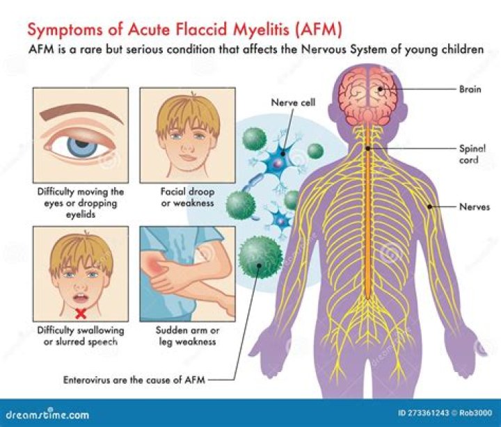 What is Mylitis?