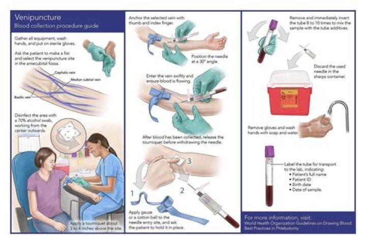 What is the most common error in phlebotomy?