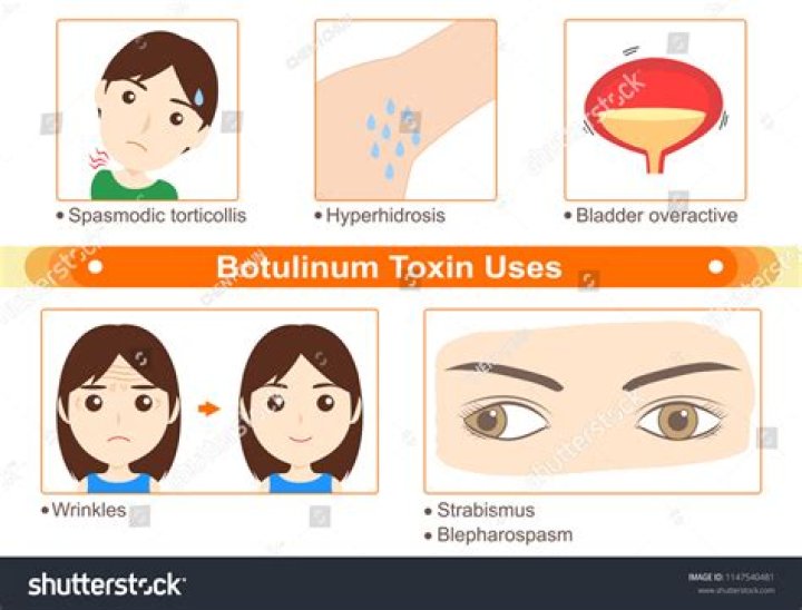 What temperature destroys botulinum toxin?