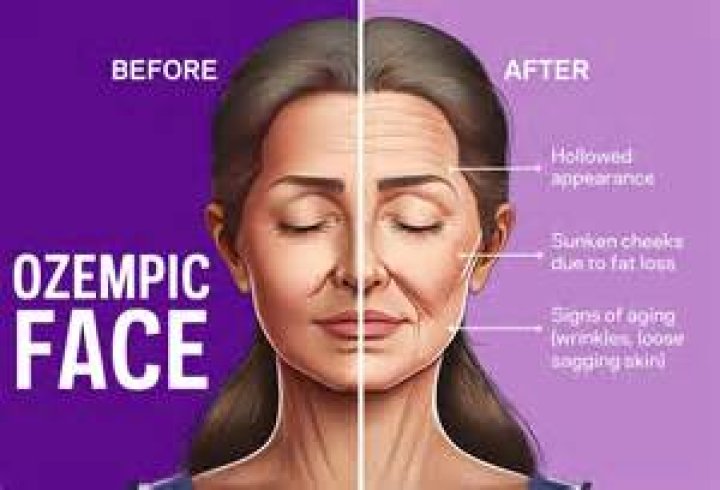 What to put in face before sleeping?
