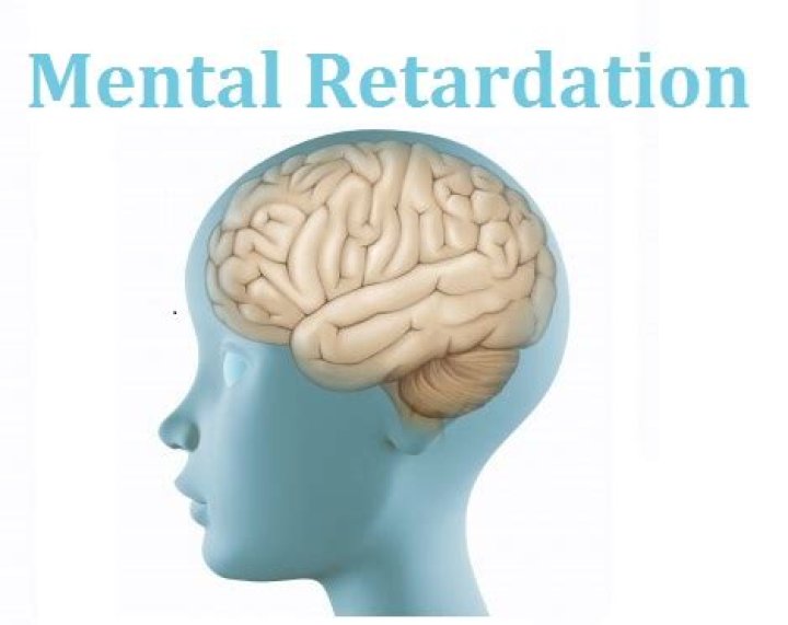 When does mental retardation show up?