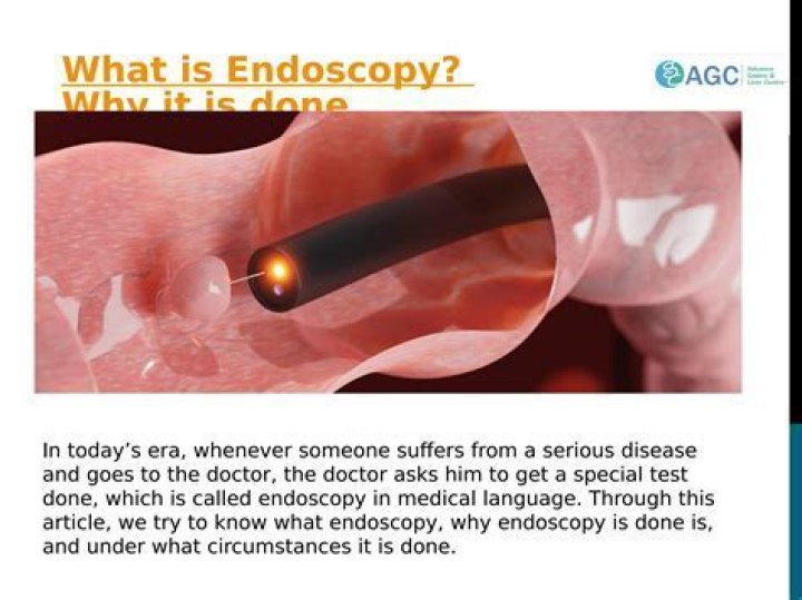 Which is better MRI or endoscopy?