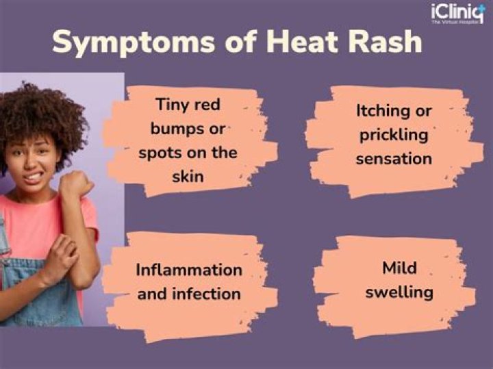 Why am I suddenly getting heat rash?