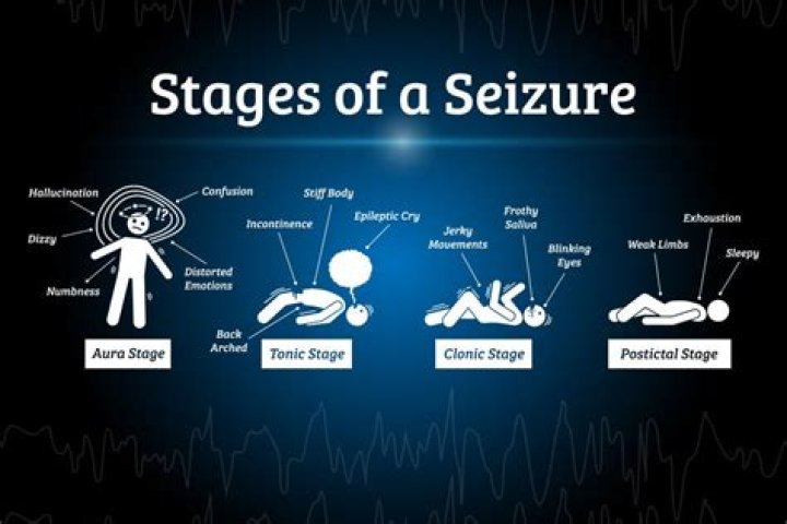 Why did I have a one off seizure?