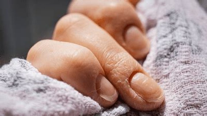 Why do doctors look at your hands?