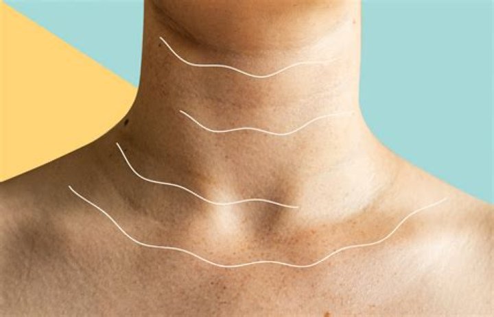 Why is my neck Brown?
