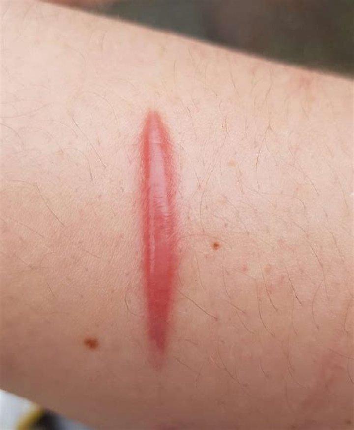 Why is my scar still red?