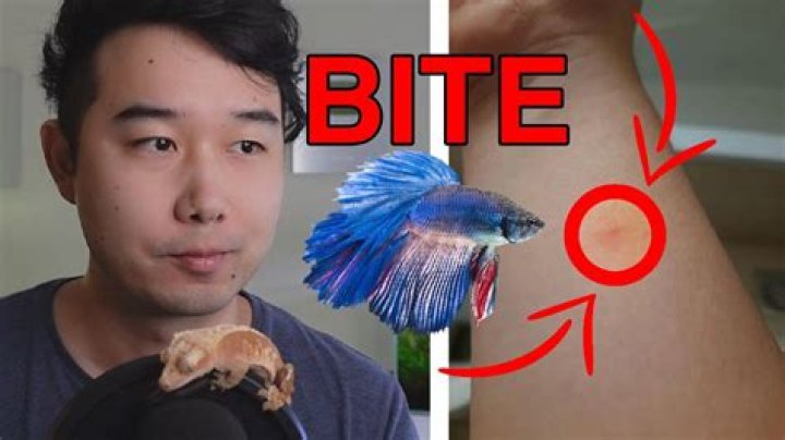 Will betta fish bite your finger?