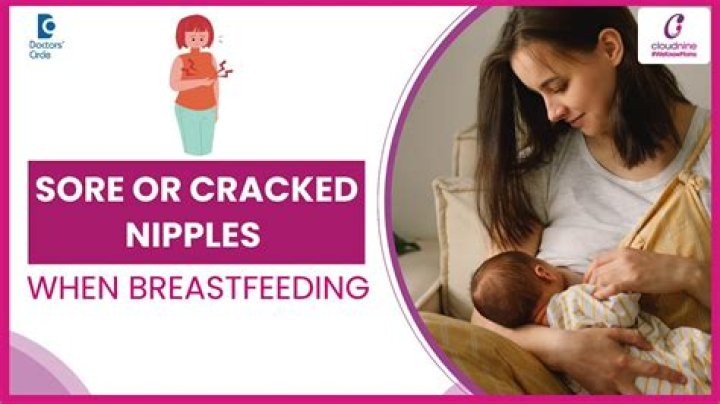 Will cracked nipples heal while breastfeeding?