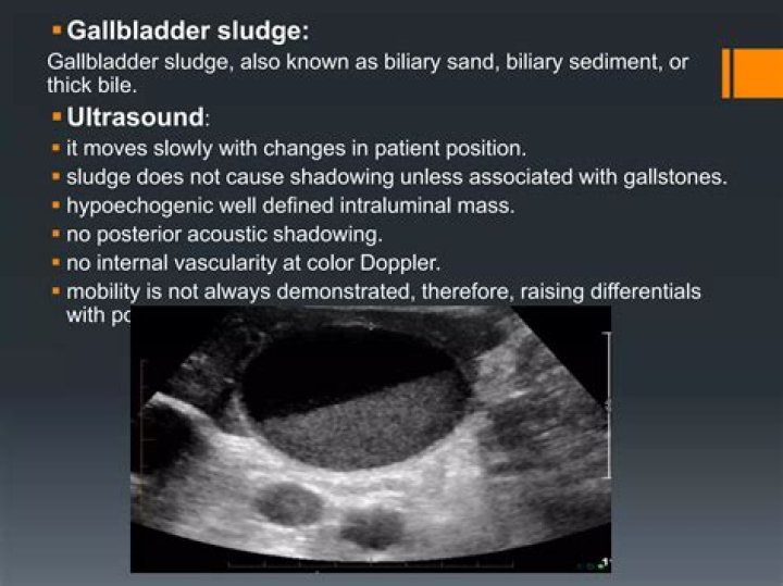 Will endoscopy show gallbladder problems?